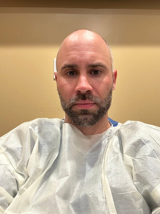 Going in for a hair transplant today boys. Wish me luck. 