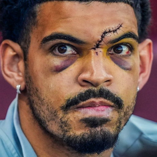 📸 Morgan Gibbs-White in the Europa League semifinal. 🤕 