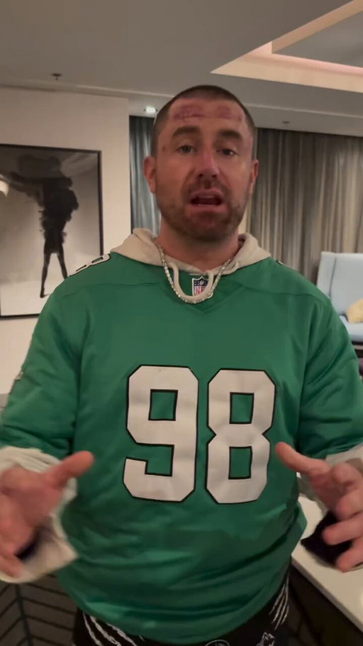 "Look at me. Im not cut, im not hurt" That forehead LMAOOO only bob man 