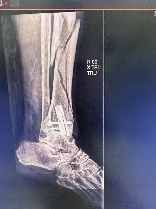 An update from Travis Pastrana… We love you buddy. 