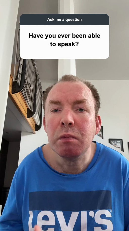 I've been asked this question hundreds of times...

"Have you ever been able to speak?"

Here's the answer, along with the story of how my voice ended up with a Geordie accent.

Leave your questions below and I'll answer another one soon. 👇

#AAC #Accessibility #AskMeAnything 