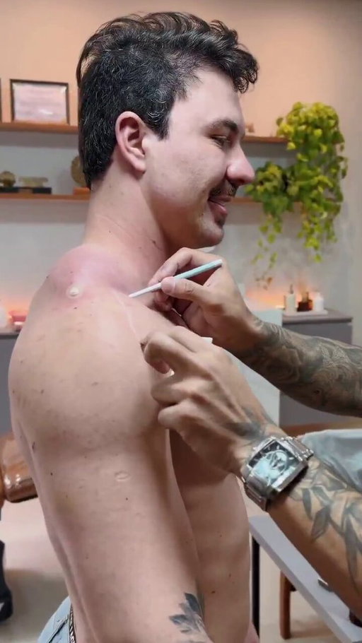 Is this that PMMA shit they using in bodybuilding now. 

What a fucking joke 