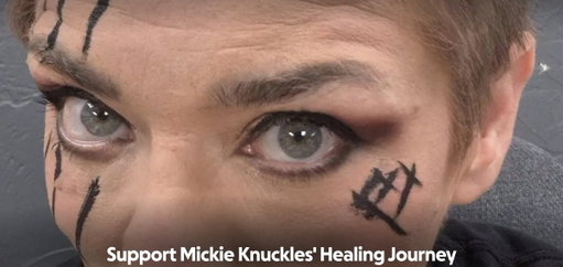 Mickie was sorely missed last weekend. If you would like to aid in her recovery please donate using the link below or simply share it.

https://www.gofundme.com/f/support-mickie-knuckles-healing-journey?attribution_id=sl%3A2840b7f5-665b-4557-8bc8-940c69e3c848&amp 