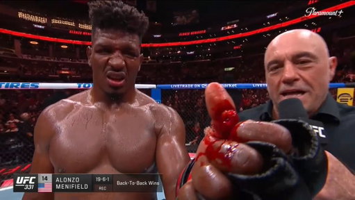 OH MY FUCKING GOD

LOOK AT ALONZO MENIFIELD’S THUMB 