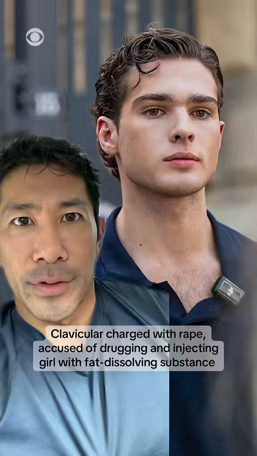 "Looksmaxxing" influencer Clavicular has been charged with rape in Massachusetts, according to online court records. He denies the allegations.

The online personality, whose real name is Braden Peters, is charged with one count of rape, one count of drugging someone for sexual intercourse and one count of procuring liquor for someone under 21 years old, according to Massachusetts court records reviewed by CBS News.

A spokesperson for Peters called the criminal charges "bogus" and said they stem from a civil suit he has refused to settle after the accuser later added allegations of sexual abuse. The spokesperson said Peters' team learned about the charges from a reporter on Monday, and said that Peters has yet to be served with an arrest warrant.