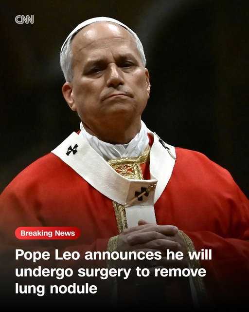 Pope Leo XIV will undergo surgery to remove a localized lung nodule. He said the nodule – a small mass of dense tissue – was detected "at a very early stage." https://t.co/MA1RZKoBRI 