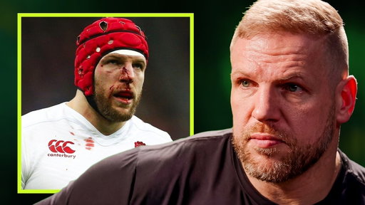 13 Surgeries Before 40: James Haskell Gets Honest About How Rugby Has Wrecked His Body