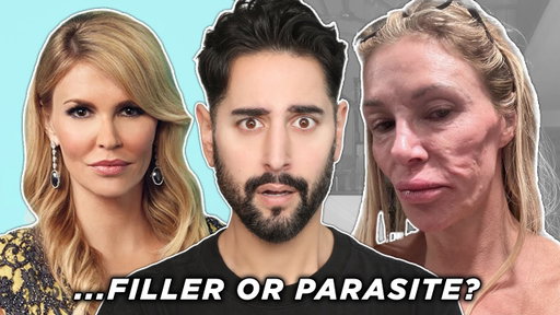Botched Filler, Parasite Or...Nair?! What Happened to Brandy Glanville's Face?