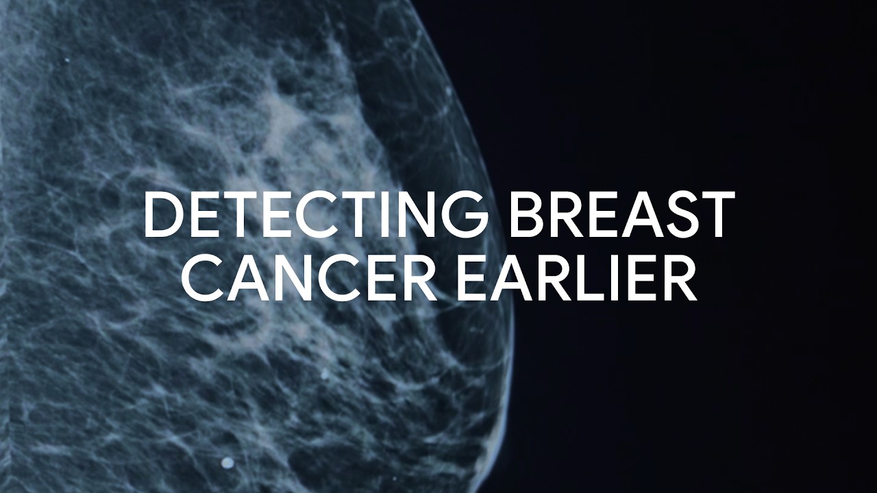 Helping Radiologists Detect Breast Cancer with AI