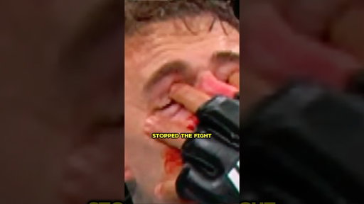 Tom Aspinall Eye Poked