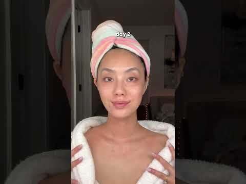 MICRONEEDLING PROGRESS #facial #microneedling #dermatologist