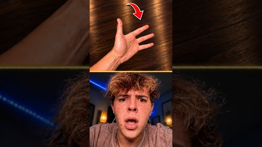 He Only Has 4 FINGERS?! 😱✋🏻