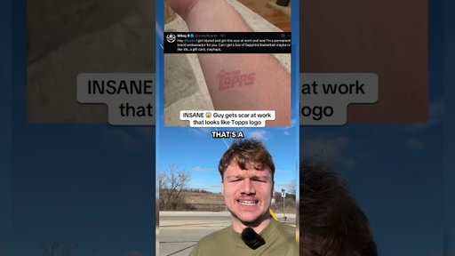 Guy Gets Topps SCAR at Work 😅
