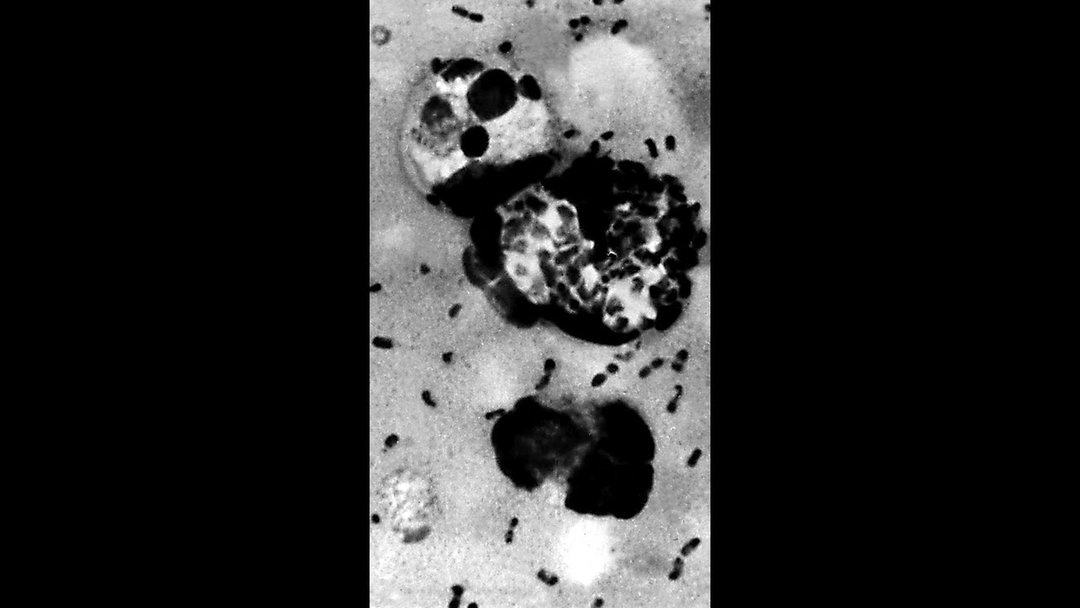 Are experts worried about a potential plague outbreak?