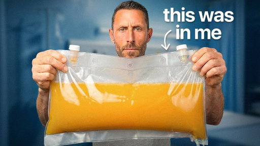 I Removed 48 Years Of Toxins From My Blood