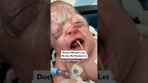 Doctors wouldn't let me see my newborn 🍼😱 #specialneeds, #specialneedsparenting, #geneticdisorder