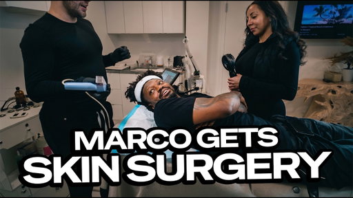 Marco gets skin surgery