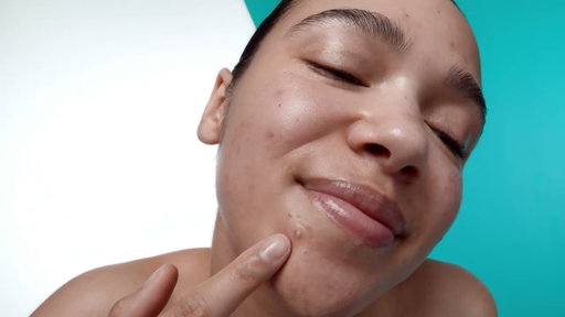 CeraVe Blemish Barrier Patches