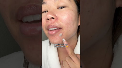 peeling off my pimple patch 🤩 #acne #pimplepatch #skincare #skincareroutine #honestreview