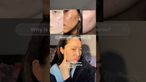 3 skincare mistakes that makes acne worse! 🥲 #acneproneskin