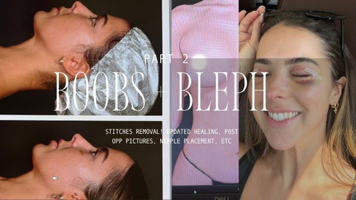 TW: Stitches and Bruises - BLEPH AND BOOB PART 2