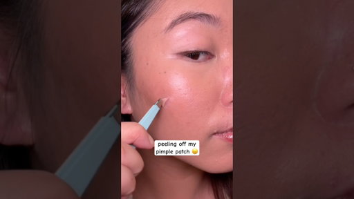 im back with more pimple patch peels 😈 #skincareroutine #acne #pimplepatch #skincare