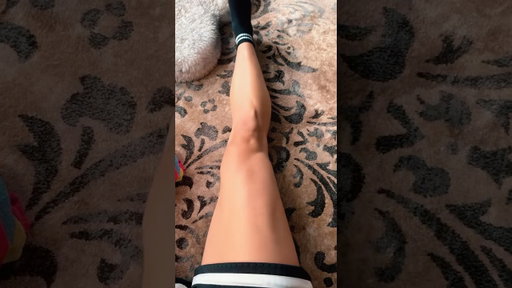 1 week of muscle loss is crazy 😅 #aclinjury #muscle #atrophy