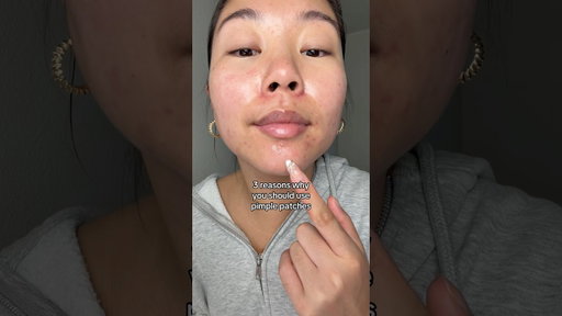 pimple patches are better than pimple popping 🙂‍↕️ #acne #skincare #skincareroutine #pimplepatch