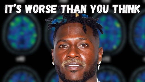 Why The NFL’s CTE Problem Is Worse Than You Think