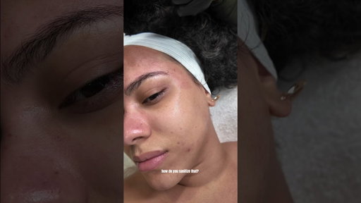 Microneedling is so good for your skin #skincareroutine #microneedling #skintreatment