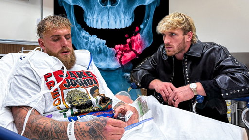 Anthony Joshua Broke My Brother’s Jaw