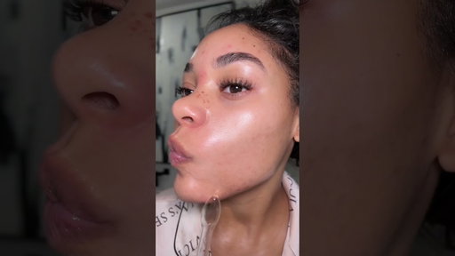 Once I see a pimple…ZAP ZAP! A must have for my cystic acne. 😩