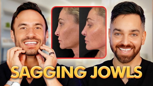 The ULTIMATE Guide to Treating Sagging Jowls | Doctorly Explains