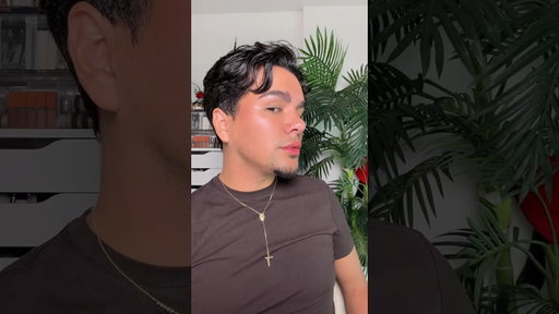 I got the Nefertiti Neck lift with #botox and these are my results