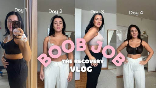THE WEEK AFTER SURGERY |VLOG| SPEND THE WEEK WITH ME |UPLIFT AND IMPLANT