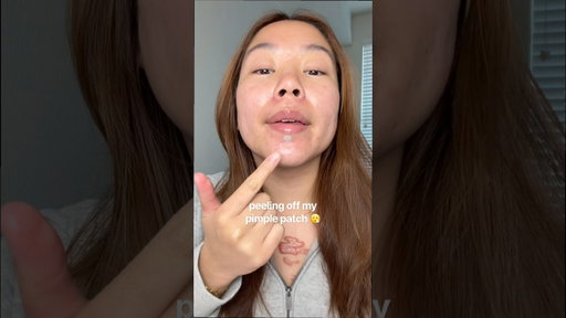 peeling off my juicy pimple patch 😮‍💨 #pimplepatch #acne #skincare #acneskincare #pimple