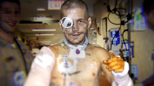 He Thought He Was Dying Then Woke Up Five Weeks Later