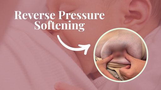 Reverse Pressure Softening for Engorgement Relief | Help Baby Latch Easier