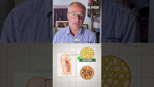 Fatty Liver to Cirrhosis Takes 7 Years Per Stage [Doctor Explains] | Dr Aleksander Krag
