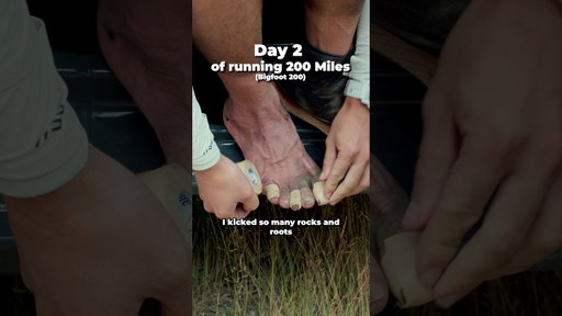 Day 2 of running 200 miles (bigfoot 200)