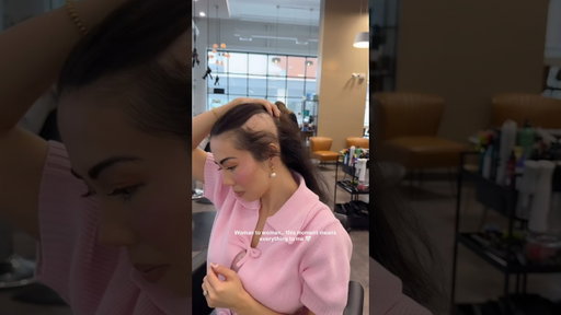 A part of me I spent years trying to hide..🤍 #alopecia