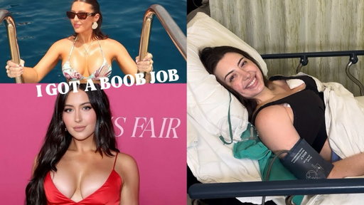 I GOT A BOOB JOB *my experience*