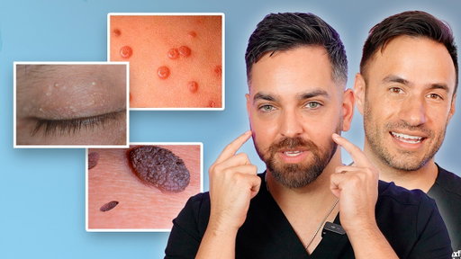 What’s Growing on Your Skin? | Dermatologists Explain