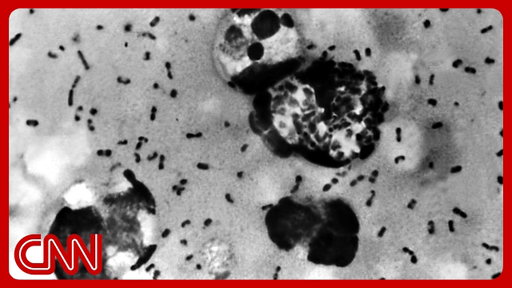 ‘Very concerned’: Doctors flag lack of transparency in Russian lab death