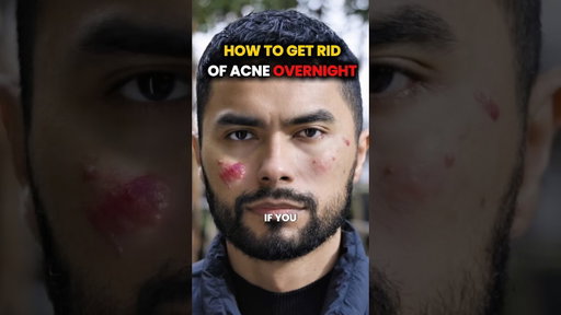Get Rid of acne OVERNIGHT