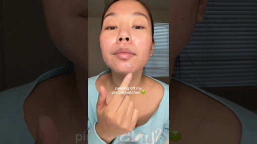 peeling off my pimple patches 🤢 #acne #skincare #skincareroutine #koreanskincare #pimplepatch