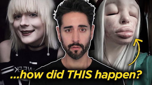 What Happened To Elva? The Hidden Crisis Behind DIY Fillers