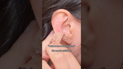 Kpop idols have been gatekeeping this face slimming secret  🙂‍↕️ using ear seeds from @byava