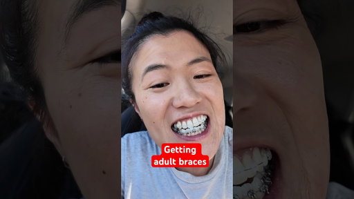 Day 1 of getting adult braces! Going to be 2 years of this and jaw surgery 😮‍💨 #orthodontics