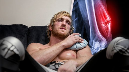 I Tore My Tricep (6 Month Recovery)